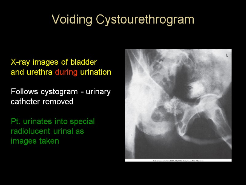 Voiding Cystourethrogram    X-ray images of bladder and urethra during urination 